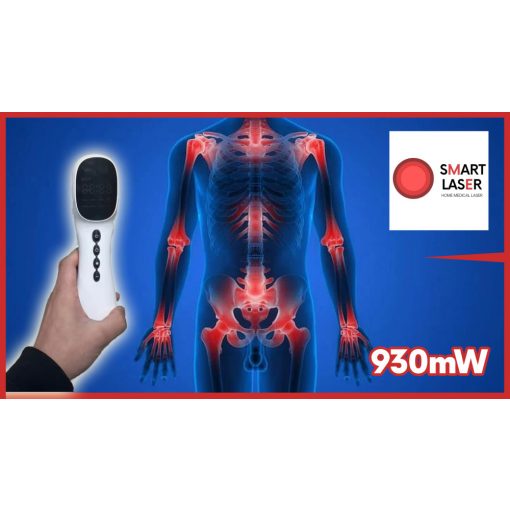 SMART LASER - HD-CURE PRO Home Medical Laser 930mW - kézi lágylézer készülék - Gyógyító lézer otthoni használatra